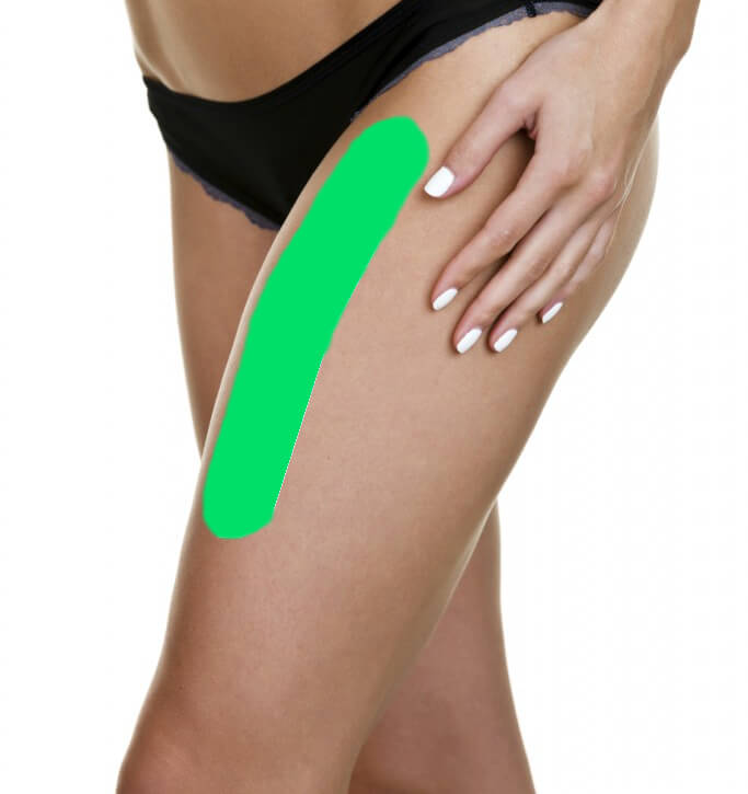 AnteriorThighExample683x1024highlight.jpg