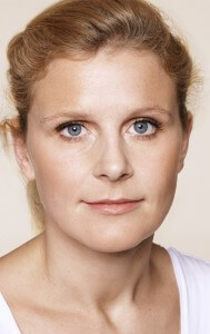 restylane_lips_after1