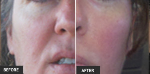 Dr. Wright, Laser Skin Tightening- Laser Lipo and Veins Center