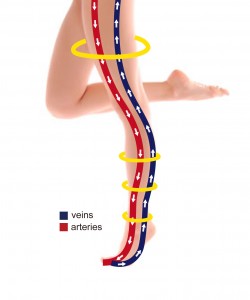 Compression Stocking Blood Circulation Diagram