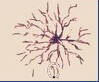 Spider Vein Diagram spider vein diagram