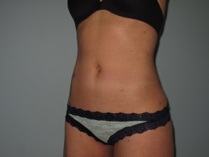 Laura.M.abs015