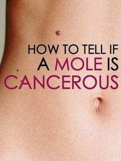 how to tell if a mole is cancerous how to tell if a mole is cancerous