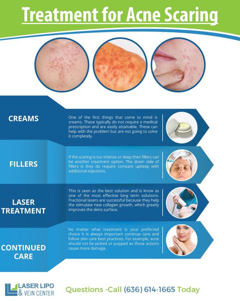 Acne Scarring infographic