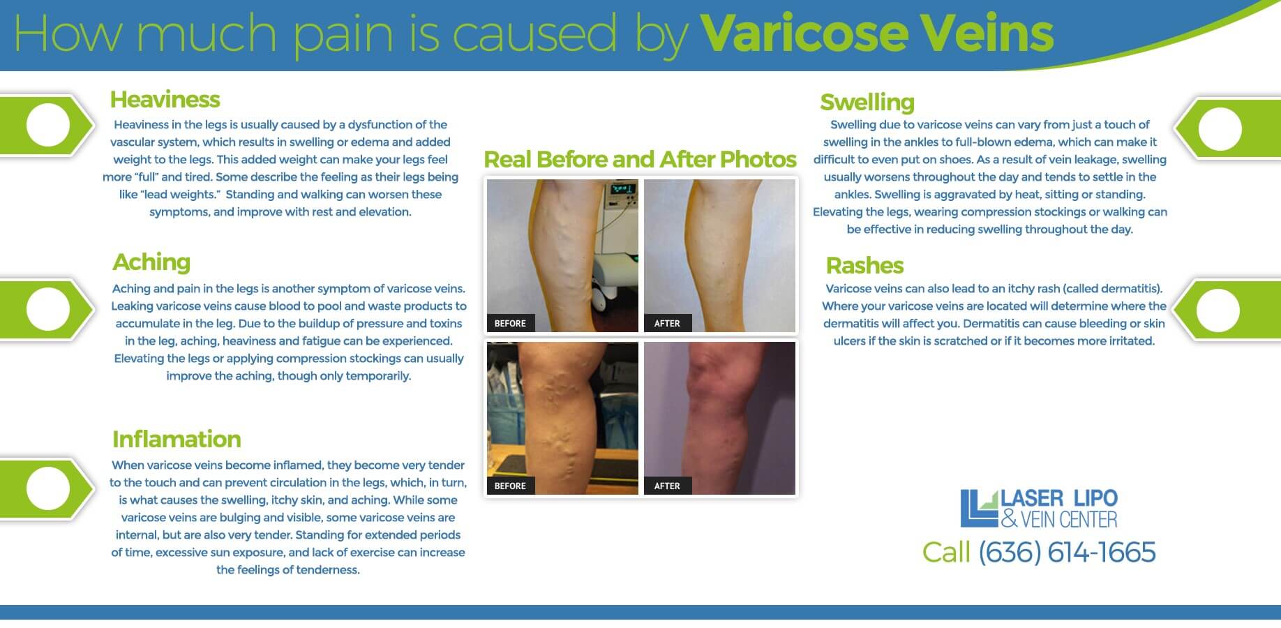 Can prostate cause leg pain Can prostate cause leg pain