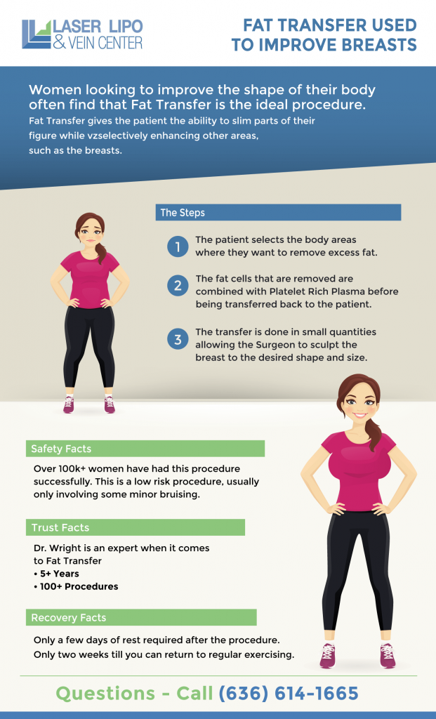 Brest Augmentation Most Asked Questions Laser Lipo and Veins Center