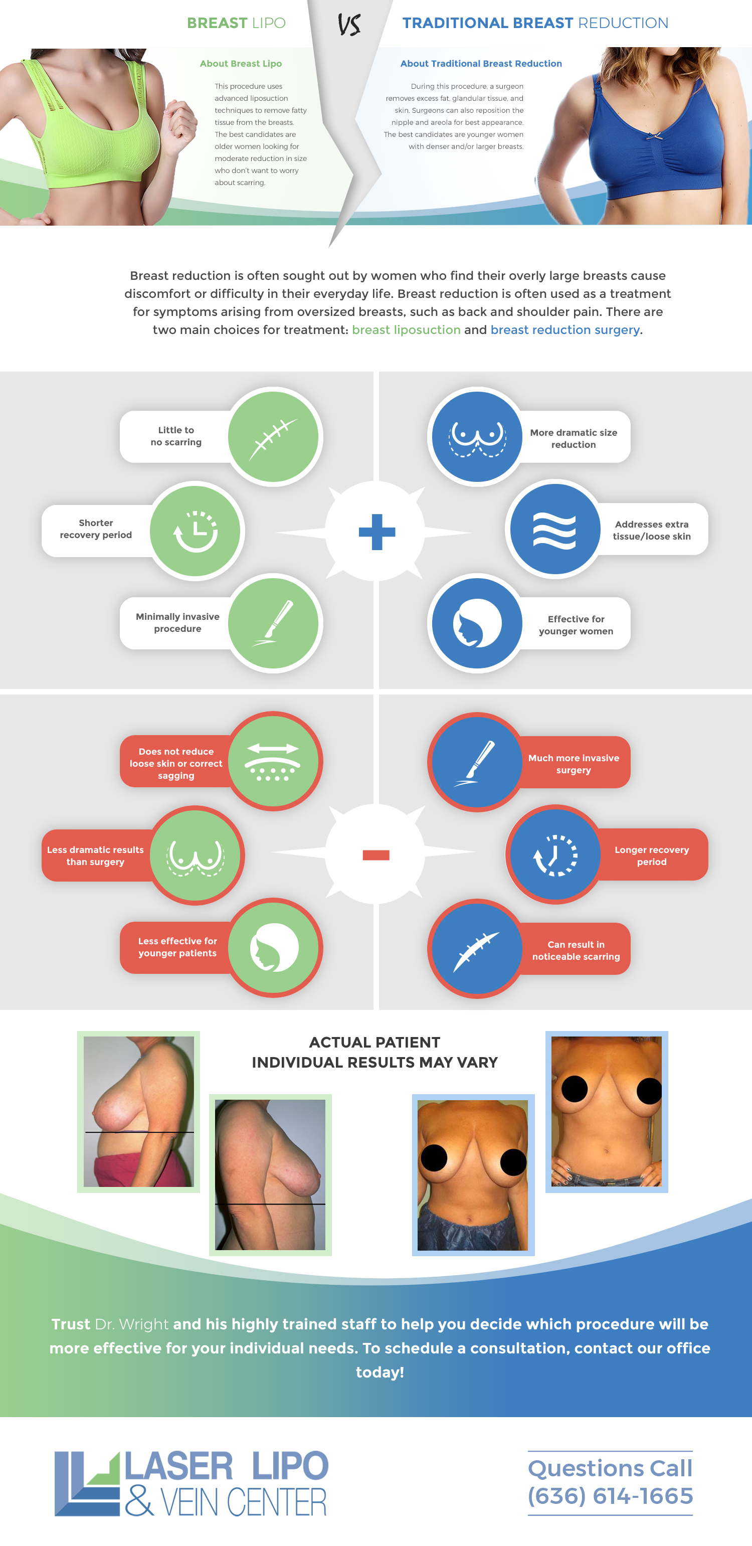 Find Out the Difference Between Breast Reduction and Breast Lipo