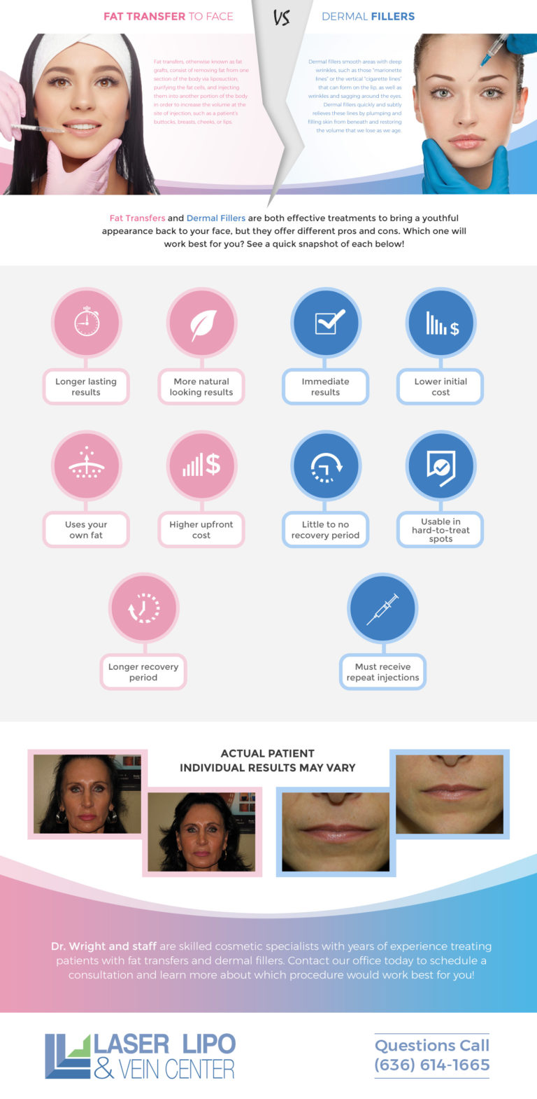 Achieve Younger Skin with Either Fat Transfer to Face or Fillers