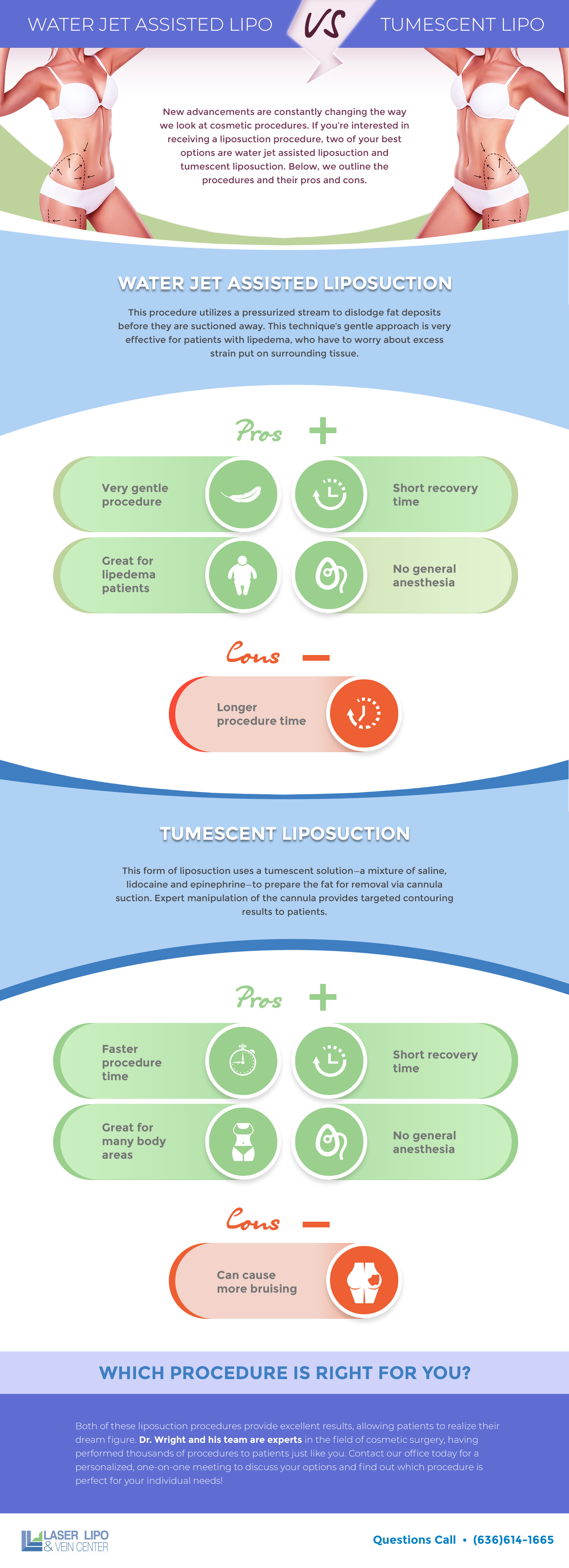 Water Jet Assisted Liposuction vs Tumescent Liposuction